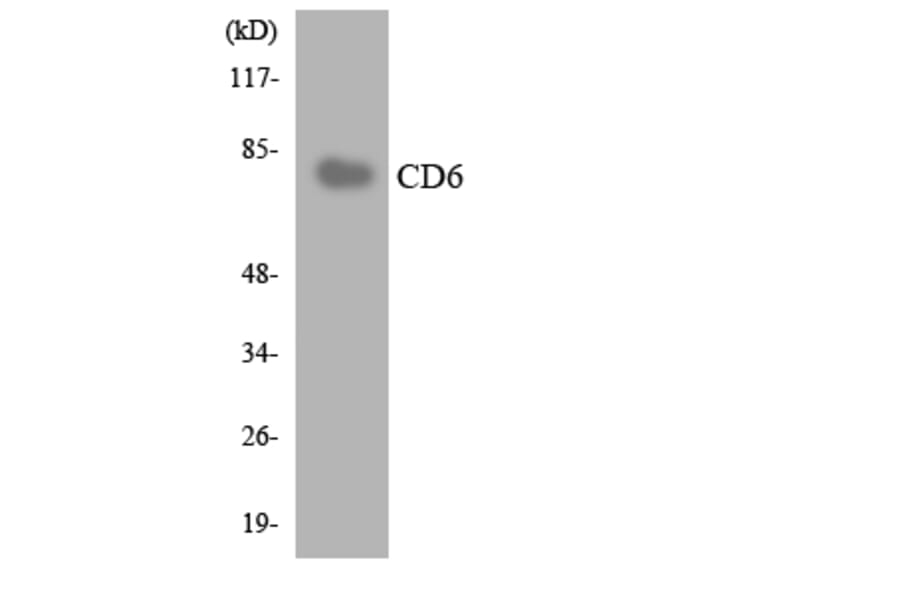 Western Blot - Anti-CD6 Antibody (R12-2590) - Antibodies.com