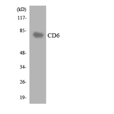 Western Blot - Anti-CD6 Antibody (R12-2590) - Antibodies.com