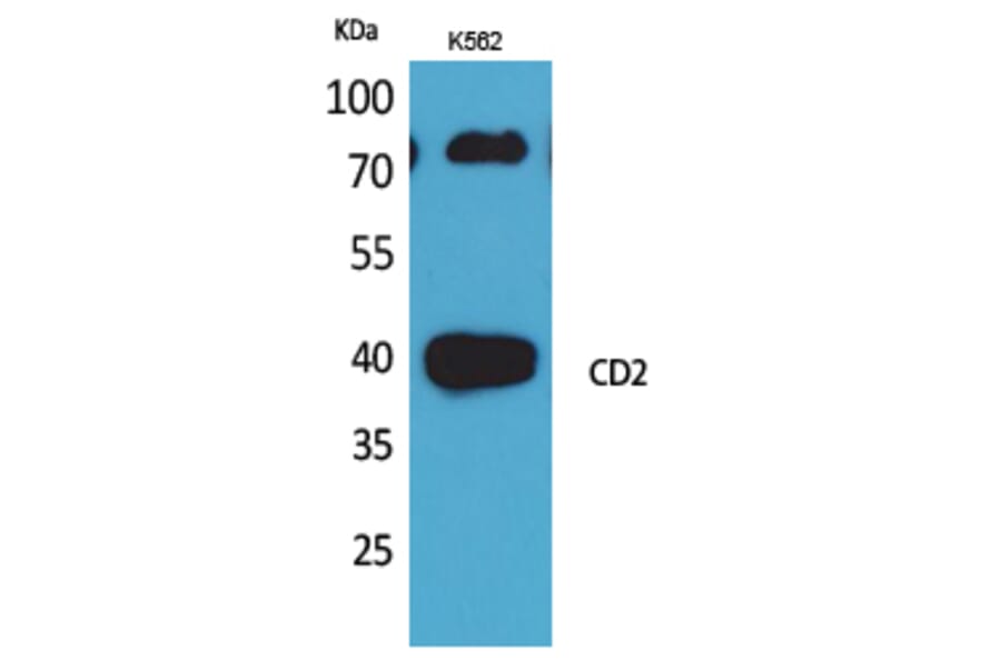 Western Blot - Anti-CD2 Antibody (C30319) - Antibodies.com