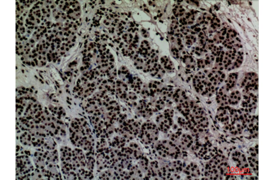 Immunohistochemistry - Anti-CD2 Antibody (C30319) - Antibodies.com
