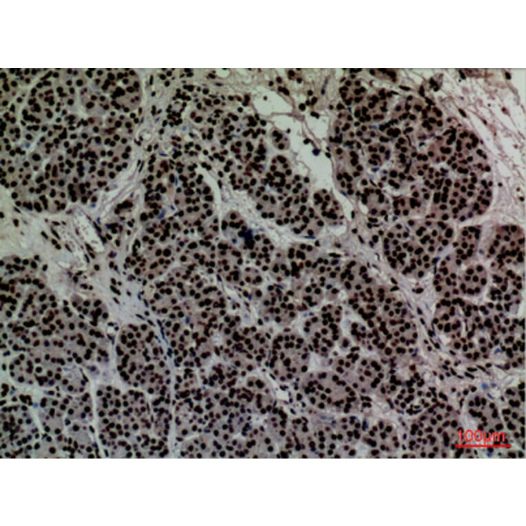 Immunohistochemistry - Anti-CD2 Antibody (C30319) - Antibodies.com