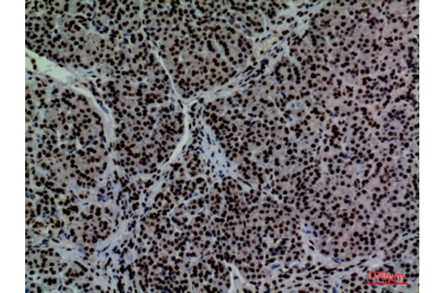 Immunohistochemistry - Anti-CD2 Antibody (C30319) - Antibodies.com