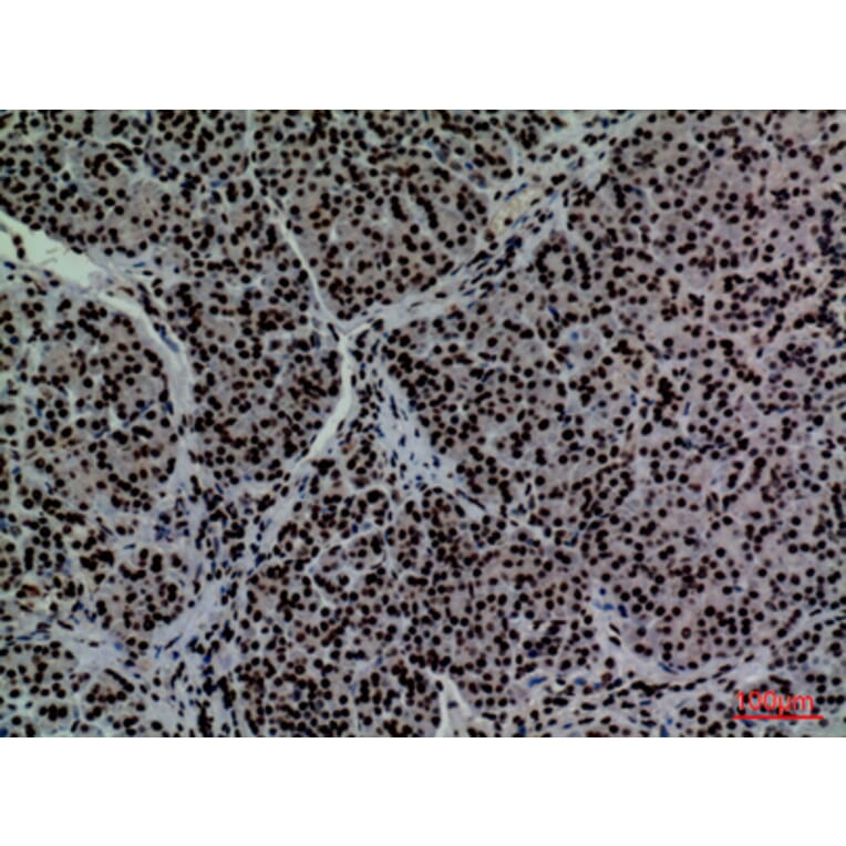 Immunohistochemistry - Anti-CD2 Antibody (C30319) - Antibodies.com