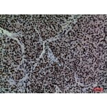 Immunohistochemistry - Anti-CD2 Antibody (C30319) - Antibodies.com