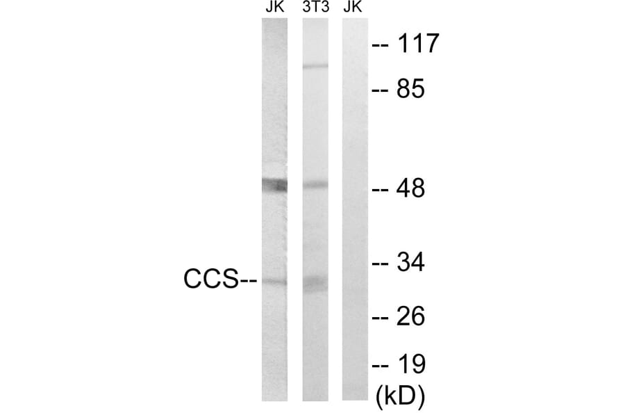 Western Blot - Anti-CCS Antibody (C15251) - Antibodies.com