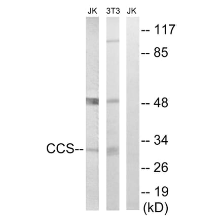 Western Blot - Anti-CCS Antibody (C15251) - Antibodies.com