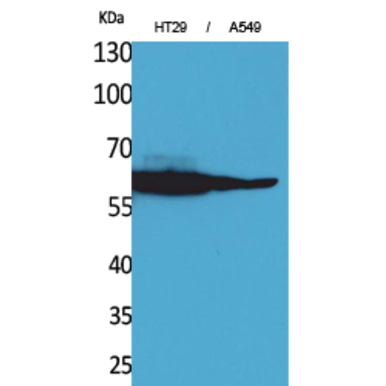 Western Blot - Anti-CAT Antibody (C30030) - Antibodies.com