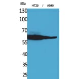 Western Blot - Anti-CAT Antibody (C30030) - Antibodies.com