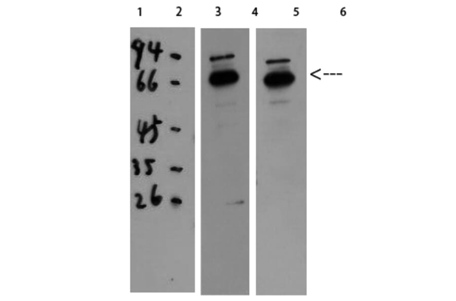 Western Blot - Anti-CAT Antibody (C30030) - Antibodies.com