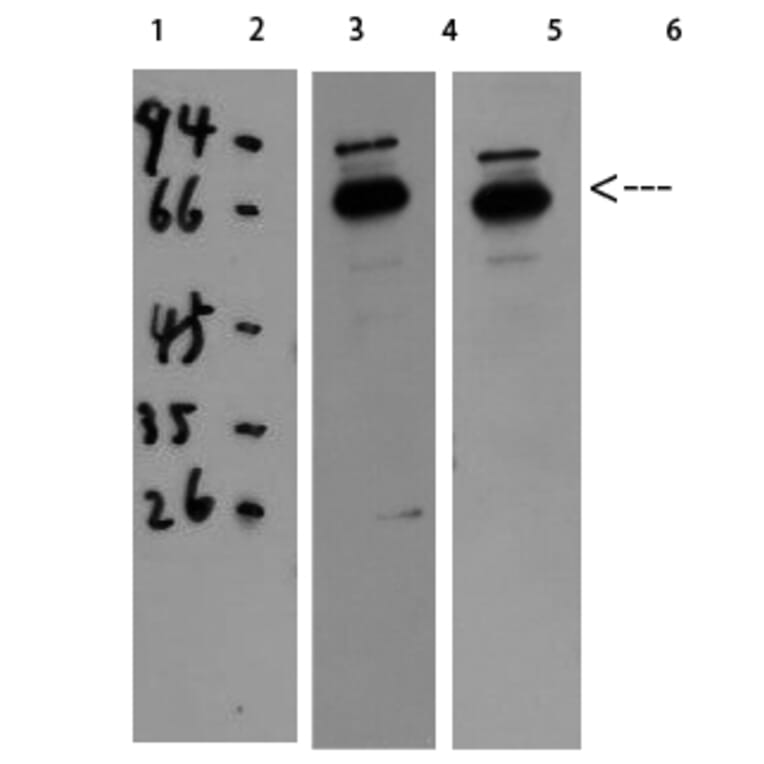 Western Blot - Anti-CAT Antibody (C30030) - Antibodies.com