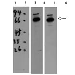Western Blot - Anti-CAT Antibody (C30030) - Antibodies.com