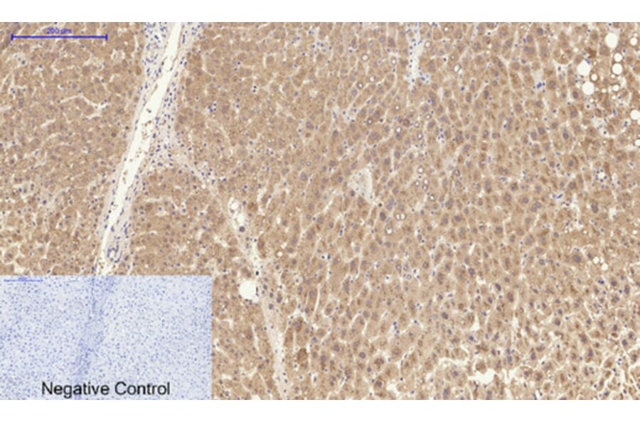 Immunohistochemistry - Anti-CAT Antibody (C30030) - Antibodies.com