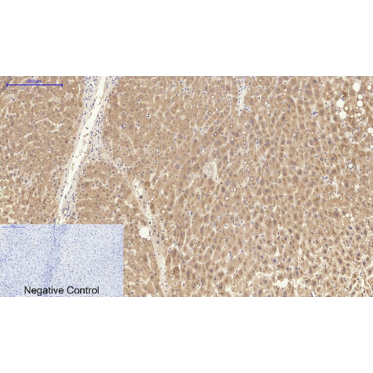 Immunohistochemistry - Anti-CAT Antibody (C30030) - Antibodies.com