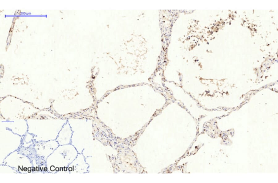 Immunohistochemistry - Anti-CAT Antibody (C30030) - Antibodies.com