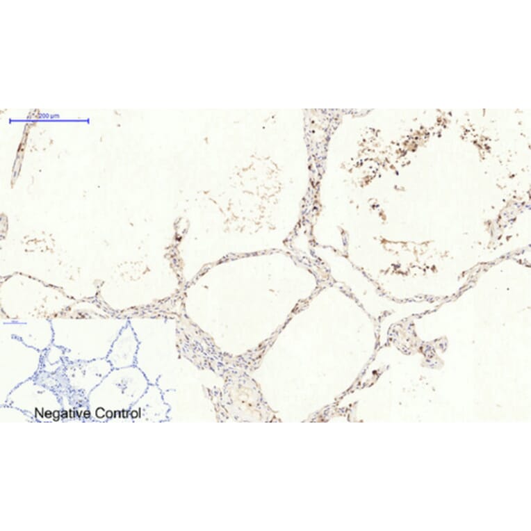 Immunohistochemistry - Anti-CAT Antibody (C30030) - Antibodies.com