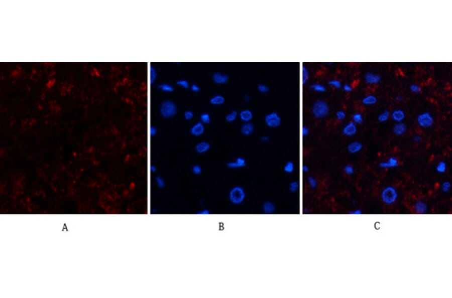 Immunofluorescence - Anti-CAT Antibody (C30030) - Antibodies.com