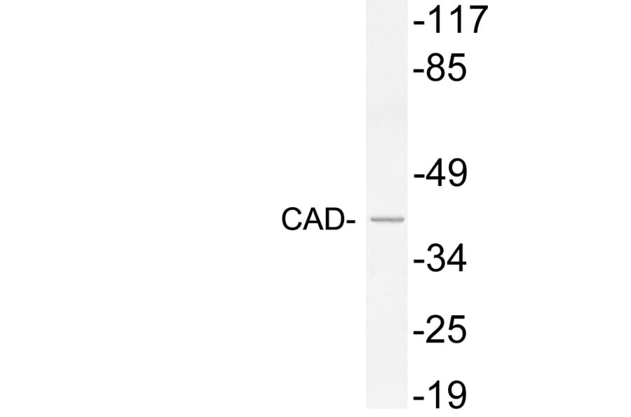 Western Blot - Anti-CAD Antibody (R12-2049) - Antibodies.com