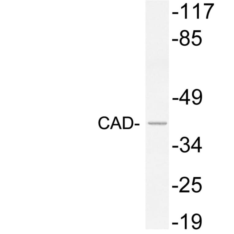 Western Blot - Anti-CAD Antibody (R12-2049) - Antibodies.com