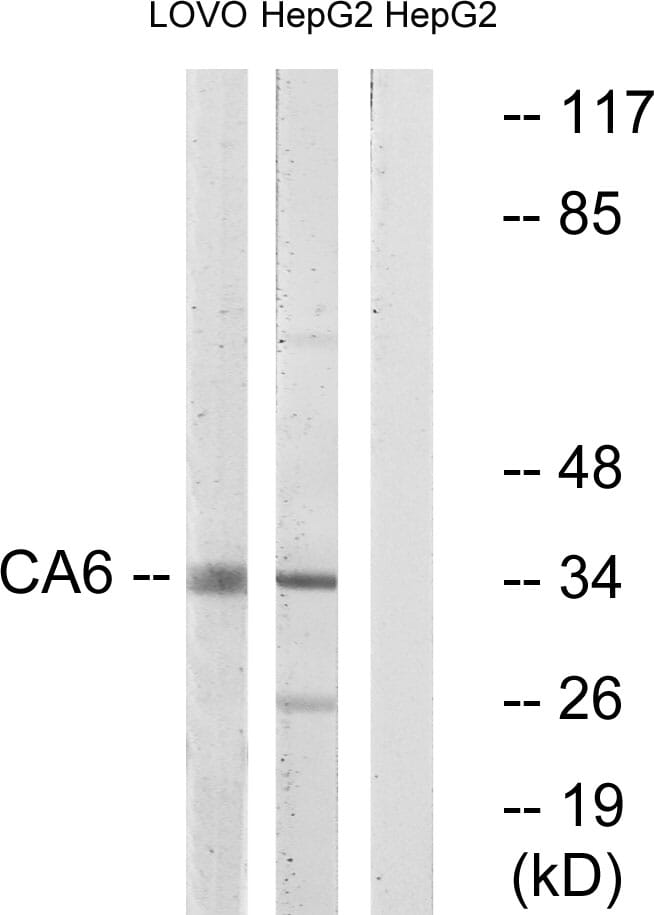 Western blot analysis of lysates from HepG and LOVO cells using Anti-CA6 Antibody. The right hand lane represents a negative control, where the antibody is blocked by the immunising peptide.