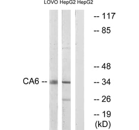 Western Blot - Anti-CA6 Antibody (C14943) - Antibodies.com
