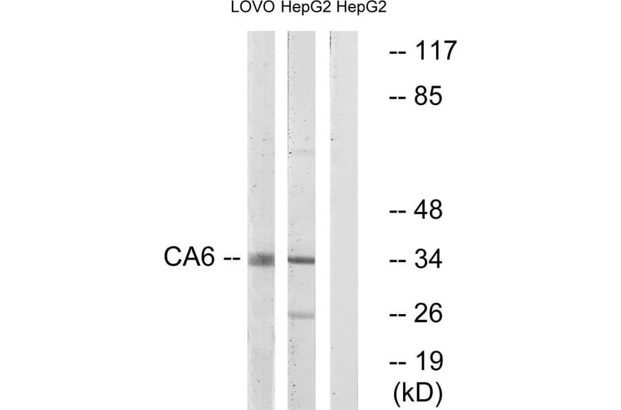 Western Blot - Anti-CA6 Antibody (C14943) - Antibodies.com