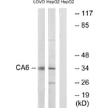 Western Blot - Anti-CA6 Antibody (C14943) - Antibodies.com