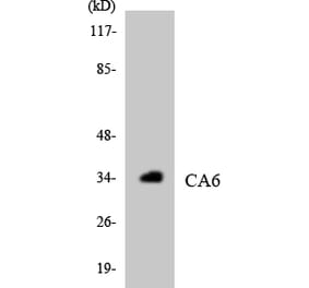 Western Blot - Anti-CA6 Antibody (R12-2559) - Antibodies.com