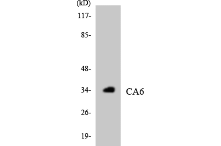Western Blot - Anti-CA6 Antibody (R12-2559) - Antibodies.com
