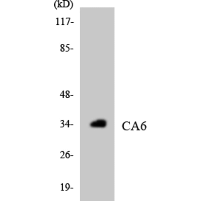 Western Blot - Anti-CA6 Antibody (R12-2559) - Antibodies.com