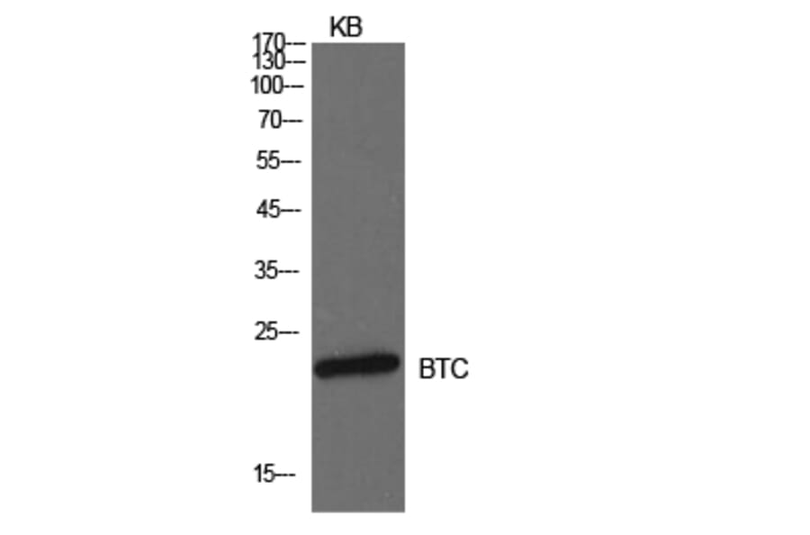 Western Blot - Anti-BTC Antibody (C30585) - Antibodies.com