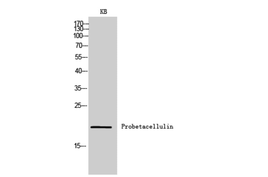Western Blot - Anti-BTC Antibody (C30585) - Antibodies.com