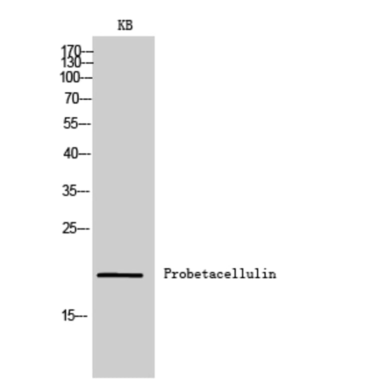 Western Blot - Anti-BTC Antibody (C30585) - Antibodies.com