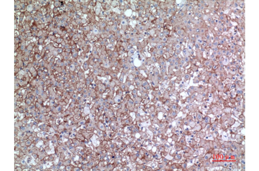 Immunohistochemistry - Anti-BSG Antibody (C30438) - Antibodies.com