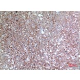 Immunohistochemistry - Anti-BSG Antibody (C30438) - Antibodies.com