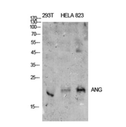 Western Blot - Anti-ANG Antibody (C30008) - Antibodies.com