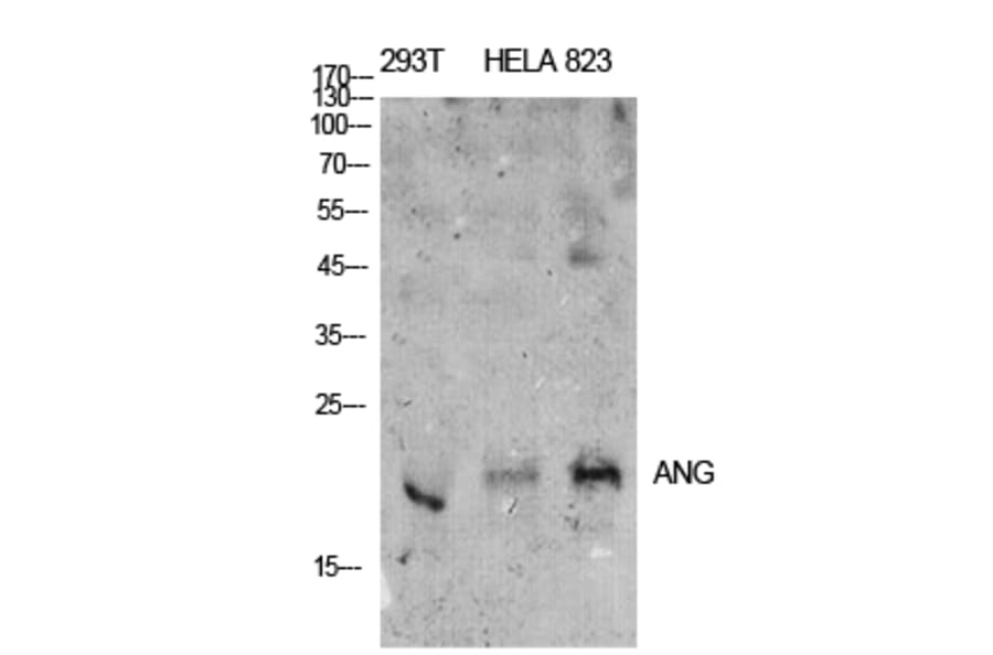 Western Blot - Anti-ANG Antibody (C30008) - Antibodies.com