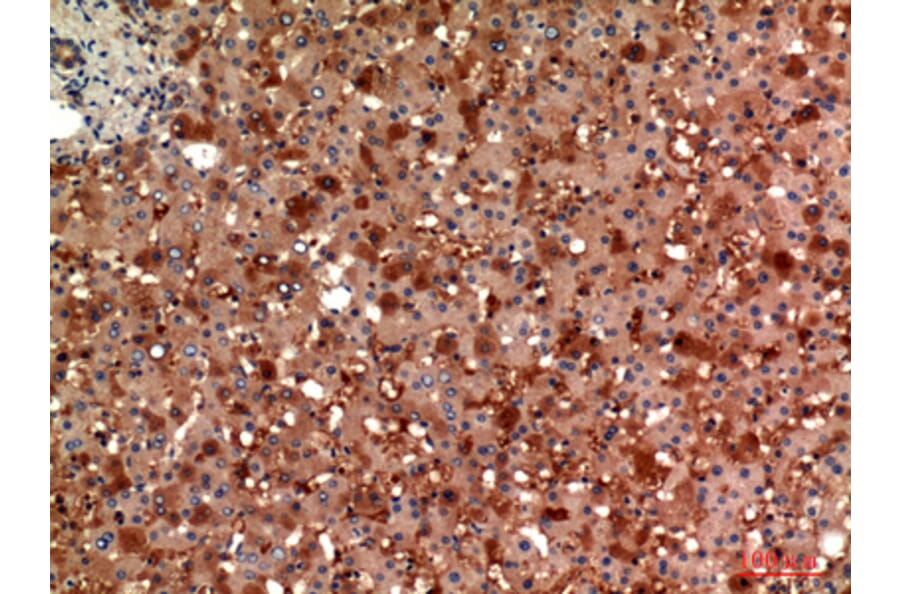 Immunohistochemistry - Anti-ANG Antibody (C30008) - Antibodies.com