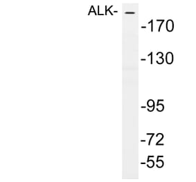 Western Blot - Anti-ALK Antibody (R12-2019) - Antibodies.com