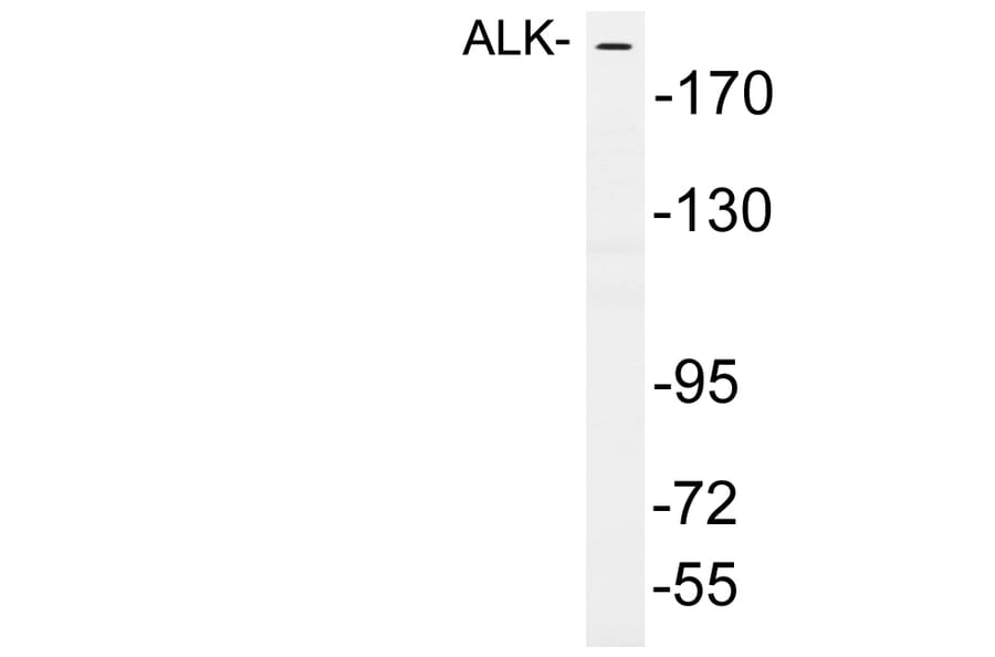 Western Blot - Anti-ALK Antibody (R12-2019) - Antibodies.com