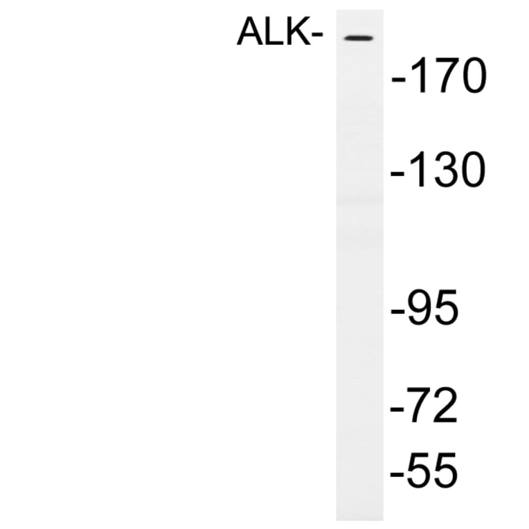 Western Blot - Anti-ALK Antibody (R12-2019) - Antibodies.com
