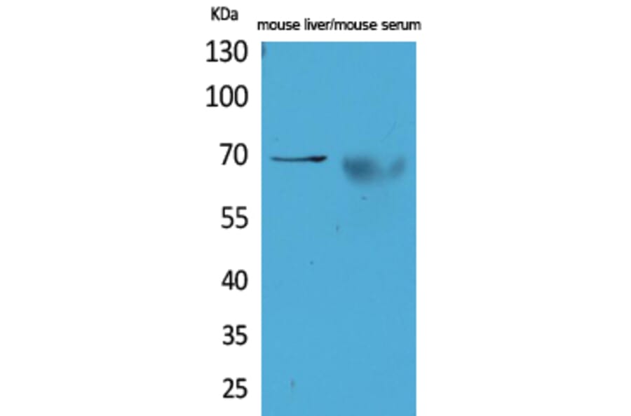 Western Blot - Anti-AFP Antibody (C30004) - Antibodies.com