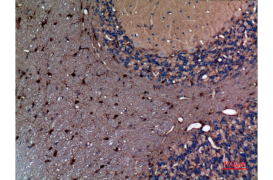 Immunohistochemistry - Anti-AFP Antibody (C30004) - Antibodies.com