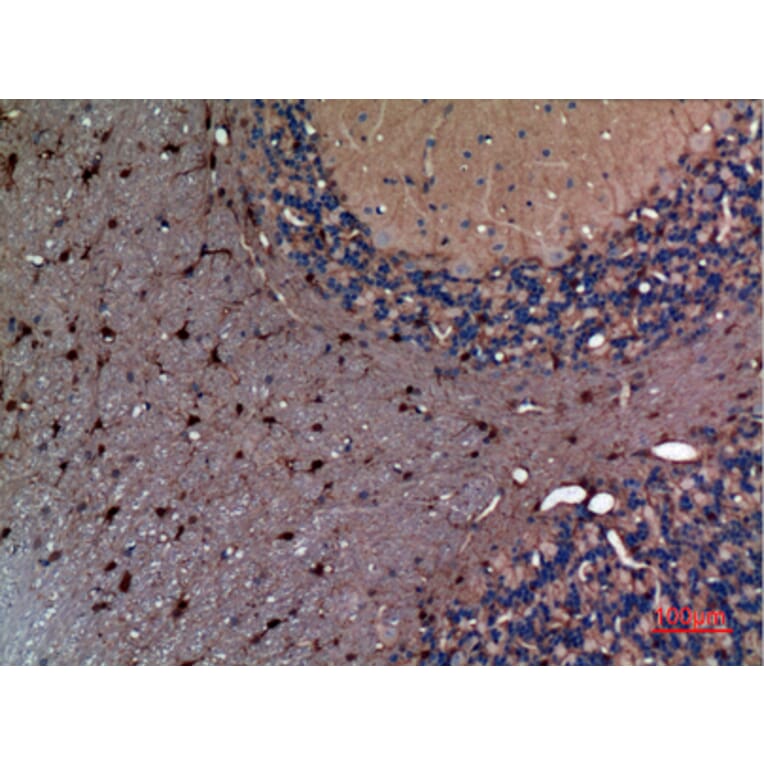 Immunohistochemistry - Anti-AFP Antibody (C30004) - Antibodies.com
