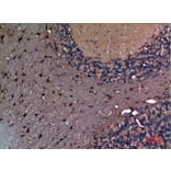 Immunohistochemistry - Anti-AFP Antibody (C30004) - Antibodies.com