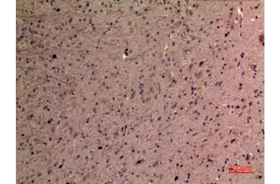Immunohistochemistry - Anti-AFP Antibody (C30004) - Antibodies.com
