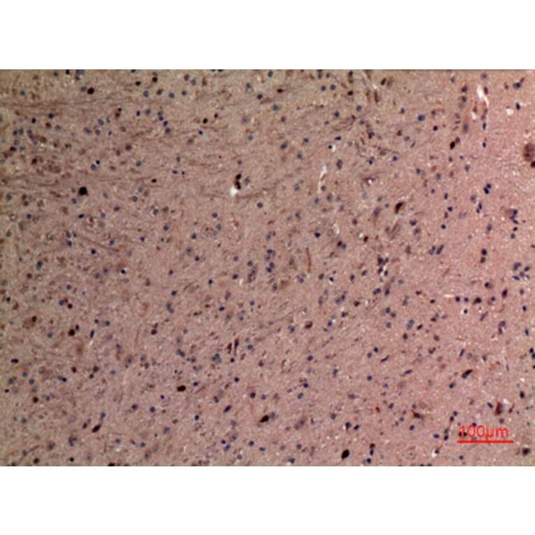 Immunohistochemistry - Anti-AFP Antibody (C30004) - Antibodies.com