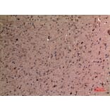 Immunohistochemistry - Anti-AFP Antibody (C30004) - Antibodies.com