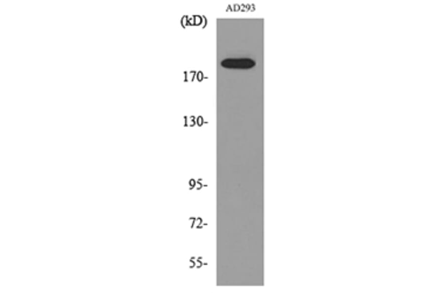 Western Blot - Anti-A2M Antibody (C30109) - Antibodies.com