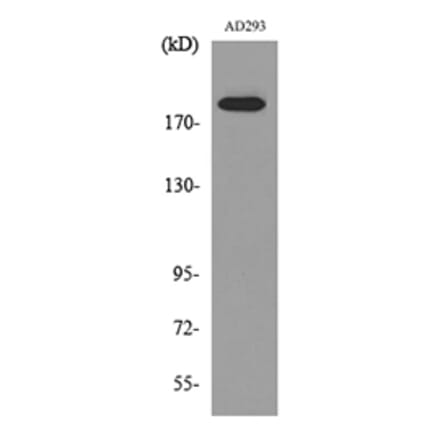 Western Blot - Anti-A2M Antibody (C30109) - Antibodies.com
