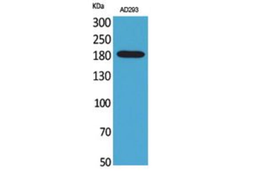 Western Blot - Anti-A2M Antibody (C30109) - Antibodies.com